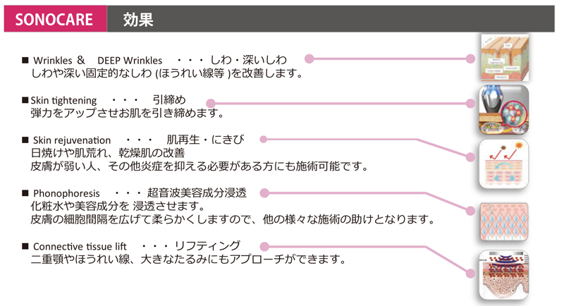 次世代IFU Sonocare/ソノケア